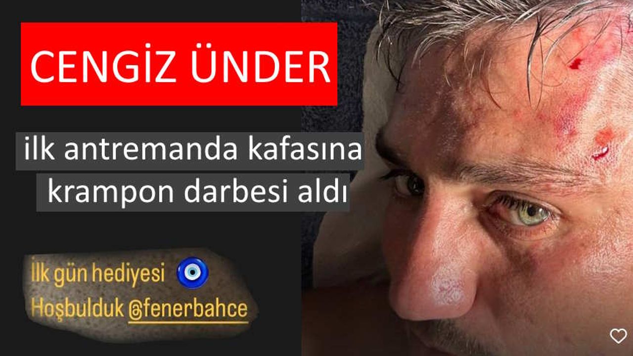 Cengiz Ünder ilk antremanda kafasına krampon darbesi aldı: Hoş Geldin Fenerbahçe