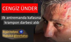 Cengiz Ünder ilk antremanda kafasına krampon darbesi aldı: Hoş Geldin Fenerbahçe