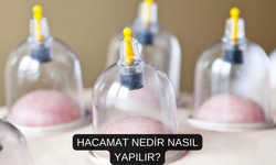 Hacamat Nedir Nasıl Yapılır? Hacamatın Faydaları Nelerdir?