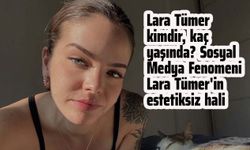 Lara Tümer kimdir, kaç yaşında? Sosyal Medya Fenomeni Lara Tümer'in estetiksiz hali