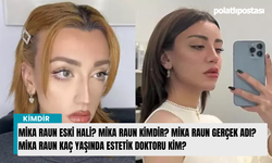 Mika Raun eski hali? Mika Raun kimdir? Mika Raun Gerçek Adı? Mika Raun kaç yaşında estetik doktoru kim?