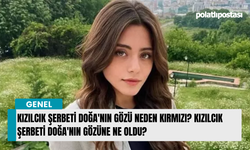 Kızılcık Şerbeti Doğa'nın Gözü neden kırmızı? Kızılcık Şerbeti Doğa'nın gözüne ne oldu?