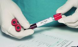 HIV ile yaşayan her 3 kişiden 1’inde frengi görüldü