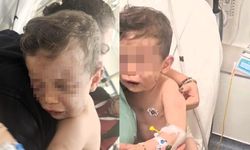 Kan donduran olay! 2 yaşındaki bebeği hastanelik ettiler