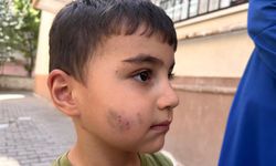 Sincan’da korkunç olay: Lağım faresi uyuyan çocuğu ısırdı
