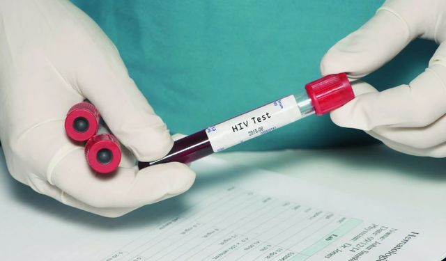 HIV ile yaşayan her 3 kişiden 1’inde frengi görüldü