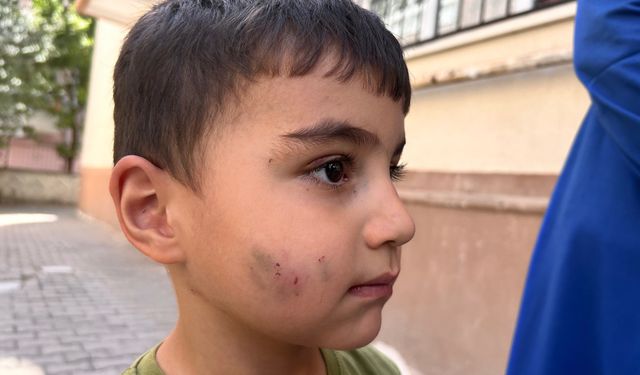 Sincan’da korkunç olay: Lağım faresi uyuyan çocuğu ısırdı