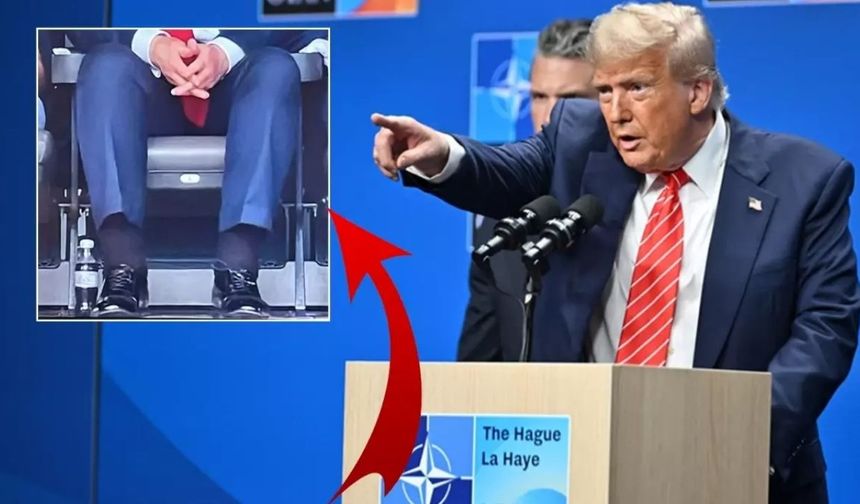 Bacaklarındaki şişlik merak edilmişti: Trump’ın hastalığı açıklandı