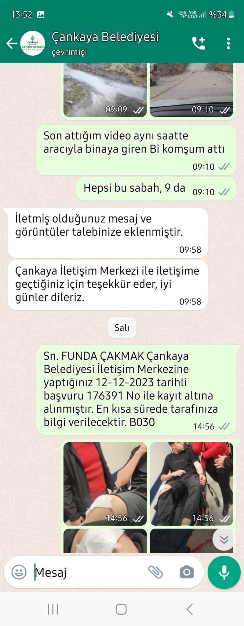 Köpek saldırısına uğrayan çocuğun ailesi, Çankaya Belediyesine dava açmaya hazırlanıyor (7)