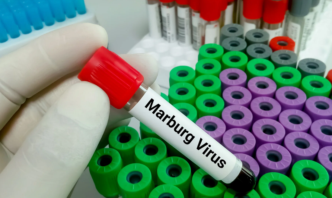 Uzmanlardan Marburg Virüsü Uyarısı! Endişeler Artıyor (1)