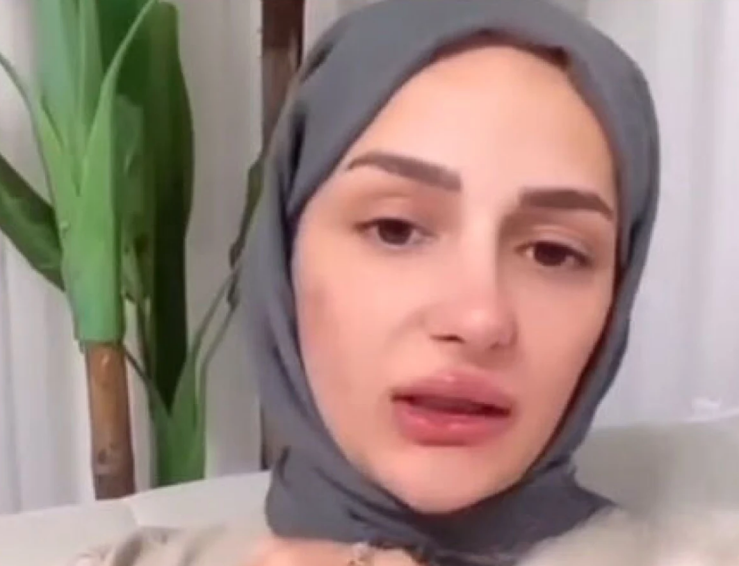 ‘Amin’ Videosuyla Gündem Olan Fenomen Estetik Mağduru Oldu! Gizem Yılmaz’ın Suratı Yandı (2)