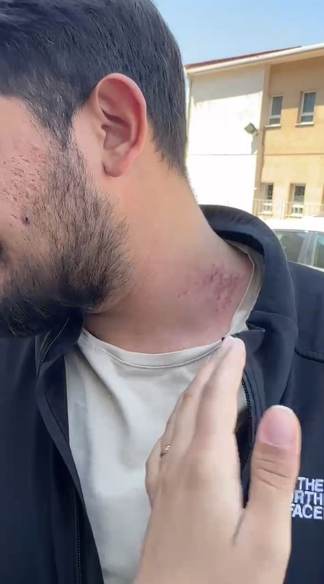 Patlamanın Gerçekleştiği Alana Giden Gazetecilere Saldırı! (3)