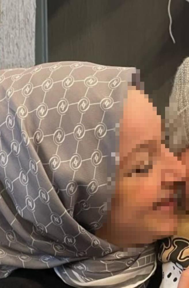 Sincan'da, Anahtarsız Eve Girmeye Çalışan Kadın Ağır Yaralandı! (2)