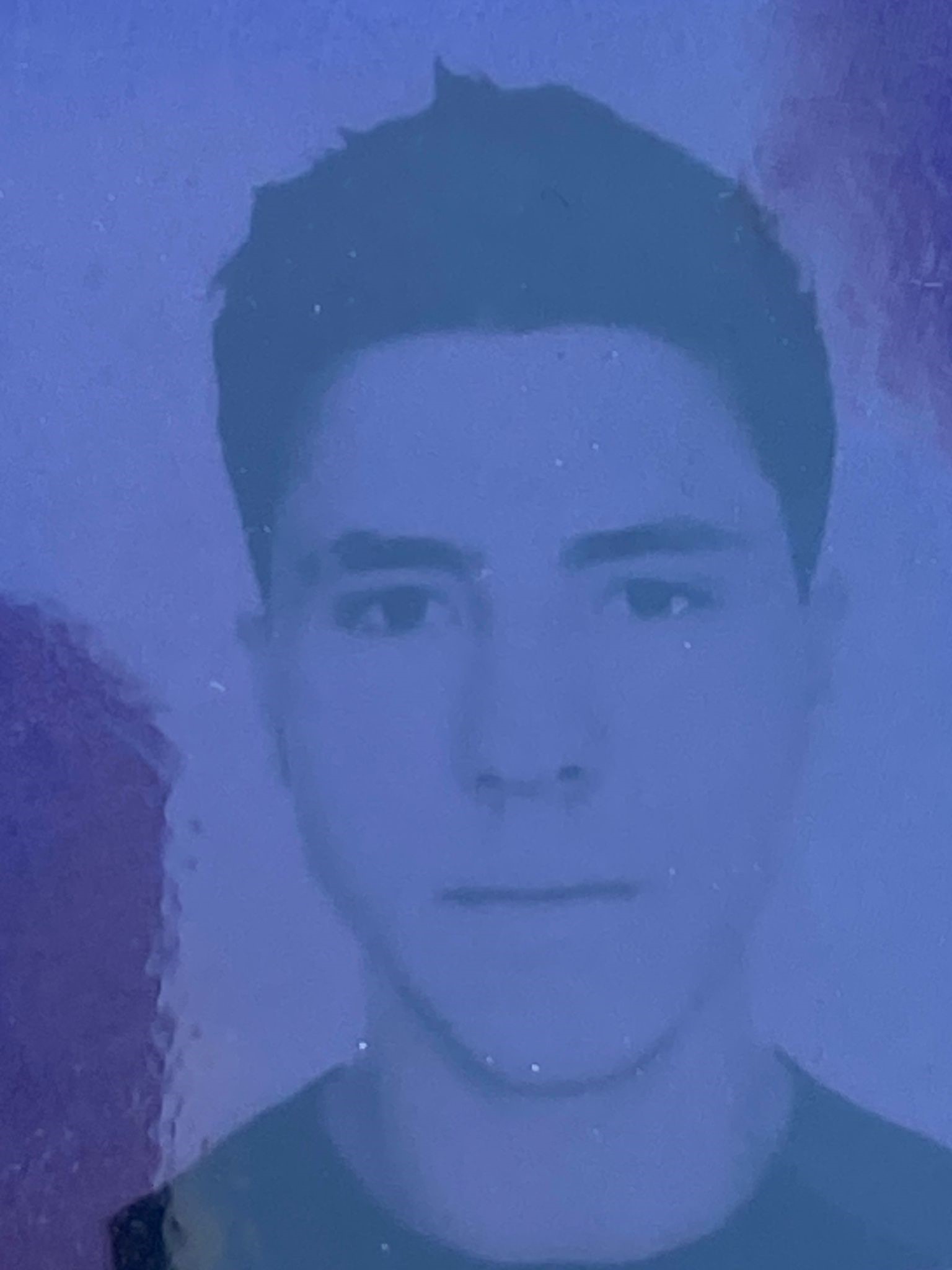 Iş Kazası-3