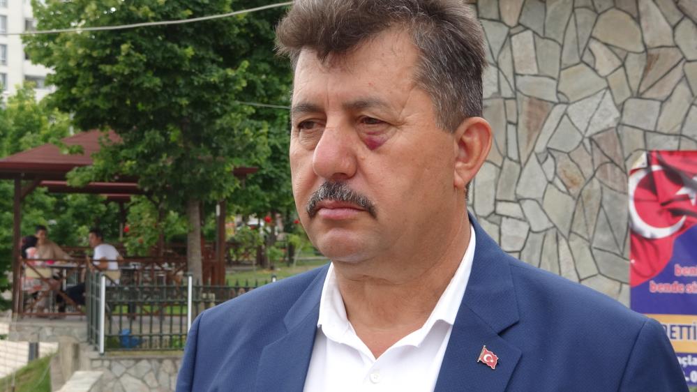 Mahalle Muhtarı, Uyardığı Kişi Tarafından Bıçaklandı! (3)